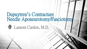 Dupuytren's Contracture Needle Aponeurotomy/Fasciotomy